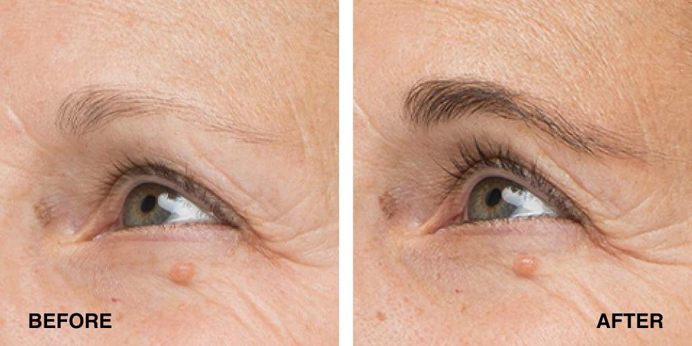 Lavonder Borw Serum Results 1