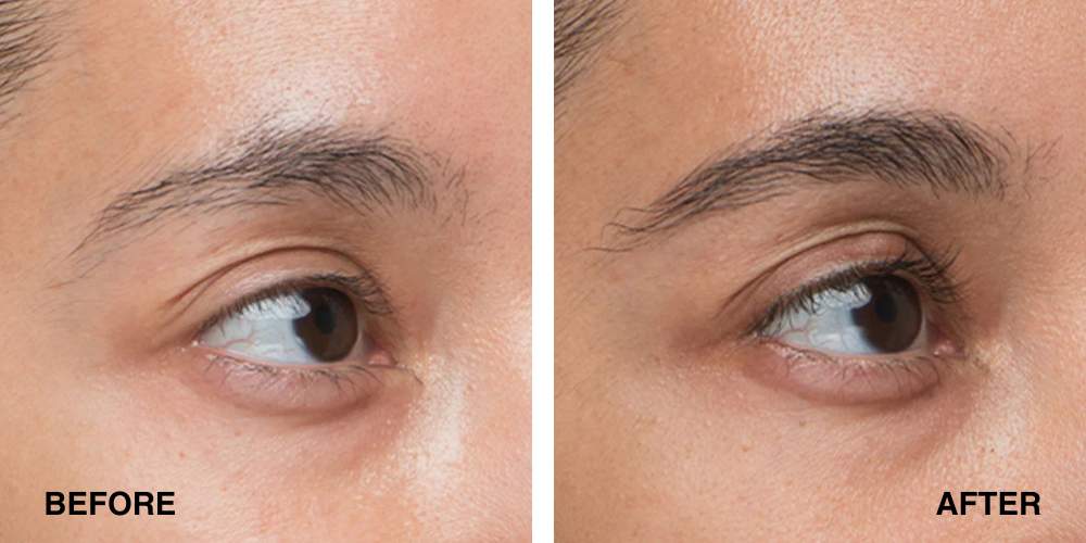 Lavonder Borw Serum Results 2